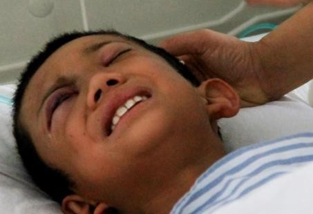 呼準(zhǔn)公路發(fā)生校車被撞事故 7名學(xué)生受傷