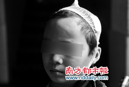 中山:兩校車相撞一學生受傷 中山:兩校車相撞一學生受傷