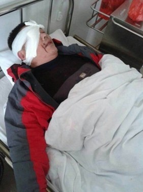 六旬老人辦理幼兒園新校車上戶遭拒 反被毆打入院