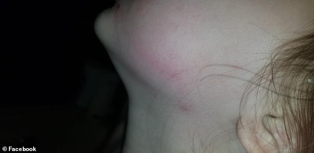 5歲的女孩臉上滿是瘀傷，原來(lái)在校車上被毆打了45分鐘