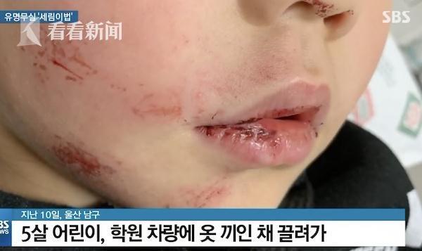 5歲女孩下校車時被門夾住 司機沒注意繼續拖行 5歲女孩下校車時被門夾住 司機沒注意繼續拖行